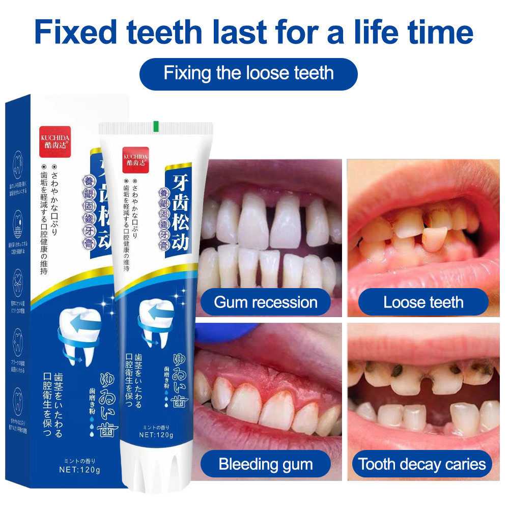  1PCS Brightening Toothpaste to Yellow Stains White Teeth Clean  Mouth Fresh Toothpaste Tooth Stains Yellow Teeth Bad Cavity Filler for Teeth  : Health & Household